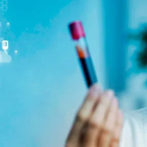 Analisis de laboratorio en CAVICA
