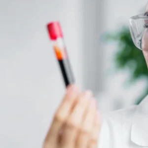 Tecnica con muestra de laboratorio CAVICA