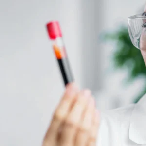 Muestra de analisis clinico en CAVICA